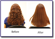 Before-and-after-Reallisse treatment