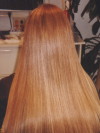 Before-and-after-Reallisse treatment